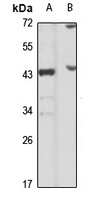 FBXO4 Rabbit Polyclonal Antibody