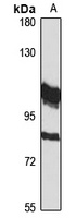 FBXO42 Rabbit Polyclonal Antibody