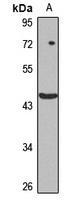 FBXW4 Rabbit Polyclonal Antibody