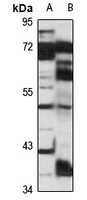 FEZF2 Rabbit Polyclonal Antibody