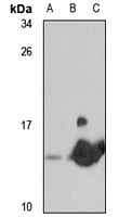 FKBP1B Rabbit Polyclonal Antibody
