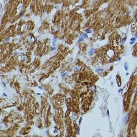 FKBP1B Rabbit Polyclonal Antibody
