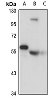 FKBP5 Rabbit Polyclonal Antibody