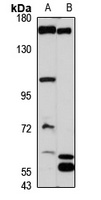 FMNL1 Rabbit Polyclonal Antibody