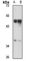 FOXL2 Rabbit Polyclonal Antibody