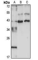 FOXR2 Rabbit Polyclonal Antibody