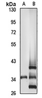 FKHL18 Rabbit Polyclonal Antibody