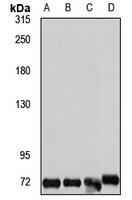 FREM1 Rabbit Polyclonal Antibody