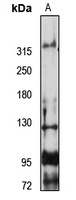 FREM2 Rabbit Polyclonal Antibody