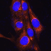 FREM2 Rabbit Polyclonal Antibody