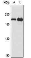 GCC2 Rabbit Polyclonal Antibody