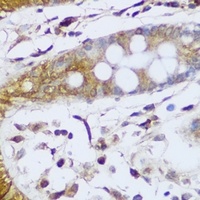 GCC2 Rabbit Polyclonal Antibody
