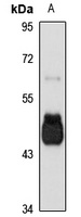 GCNT1 Rabbit Polyclonal Antibody