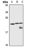 GCSH Rabbit Polyclonal Antibody