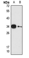 Gemin8 Rabbit Polyclonal Antibody