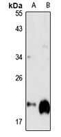 GGCT Rabbit Polyclonal Antibody