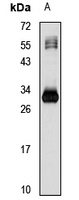 GGPS1 Rabbit Polyclonal Antibody
