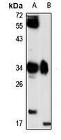 GIMAP5 Rabbit Polyclonal Antibody