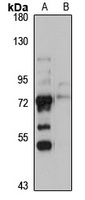 GLIS3 Rabbit Polyclonal Antibody