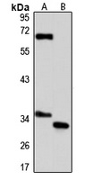 GLOD4 Rabbit Polyclonal Antibody