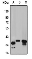 GMPR Rabbit Polyclonal Antibody