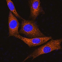 GNAT3 Rabbit Polyclonal Antibody