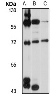GPATCH2 Rabbit Polyclonal Antibody