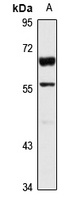 Glypican-6 Rabbit Polyclonal Antibody