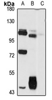 GPR133 Rabbit Polyclonal Antibody