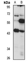 GPR139 Rabbit Polyclonal Antibody