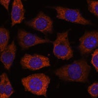GRHPR Rabbit Polyclonal Antibody