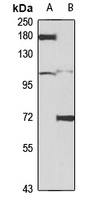mGLUR3 Rabbit Polyclonal Antibody