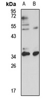 TFIIB Rabbit Polyclonal Antibody