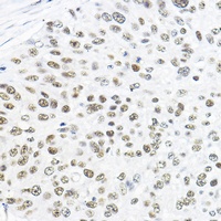 TFIIB Rabbit Polyclonal Antibody
