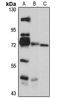 GTSE1 Rabbit Polyclonal Antibody