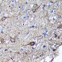 GULP Rabbit Polyclonal Antibody