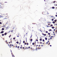 Histone H2A.V Rabbit Polyclonal Antibody