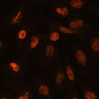 Histone H2A.V Rabbit Polyclonal Antibody