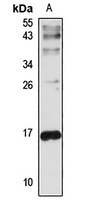 Hemoglobin beta Rabbit Polyclonal Antibody