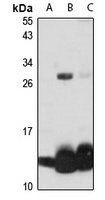 Hemoglobin beta Rabbit Polyclonal Antibody