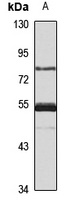 HBS1L Rabbit Polyclonal Antibody