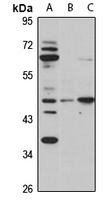 Orexin Receptor 2 Rabbit Polyclonal Antibody