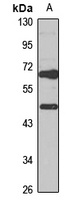 HGD Rabbit Polyclonal Antibody
