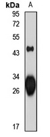 HLA-DRB3 Antibody