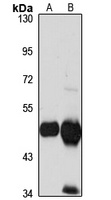 HMGCS2 Rabbit Polyclonal Antibody