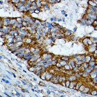 HMGCS2 Rabbit Polyclonal Antibody