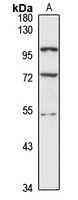 hnRNP H2 Rabbit Polyclonal Antibody