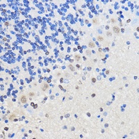 hnRNP U Rabbit Polyclonal Antibody