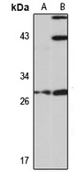 HoxC4 Rabbit Polyclonal Antibody