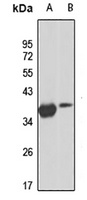 HOXD10 Rabbit Polyclonal Antibody